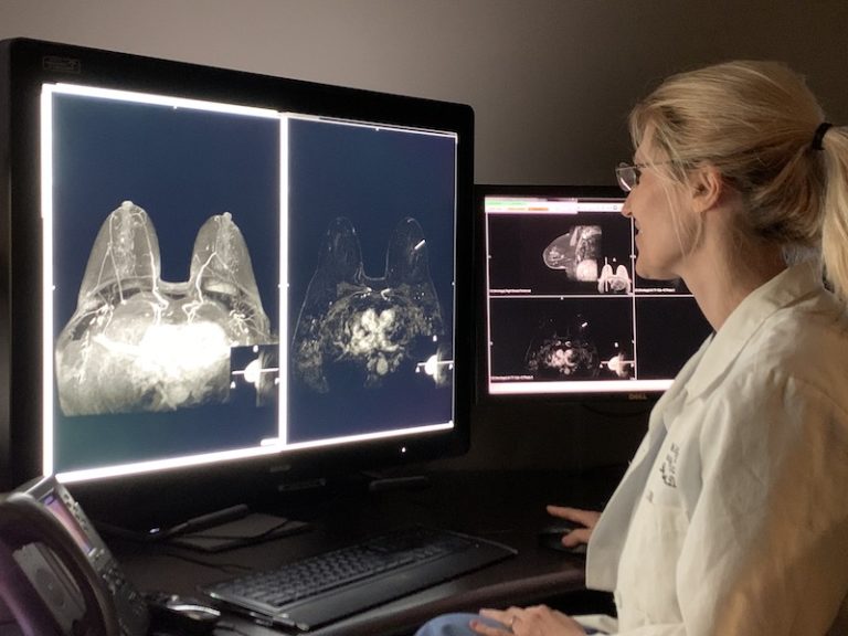 doctor reading a breast image