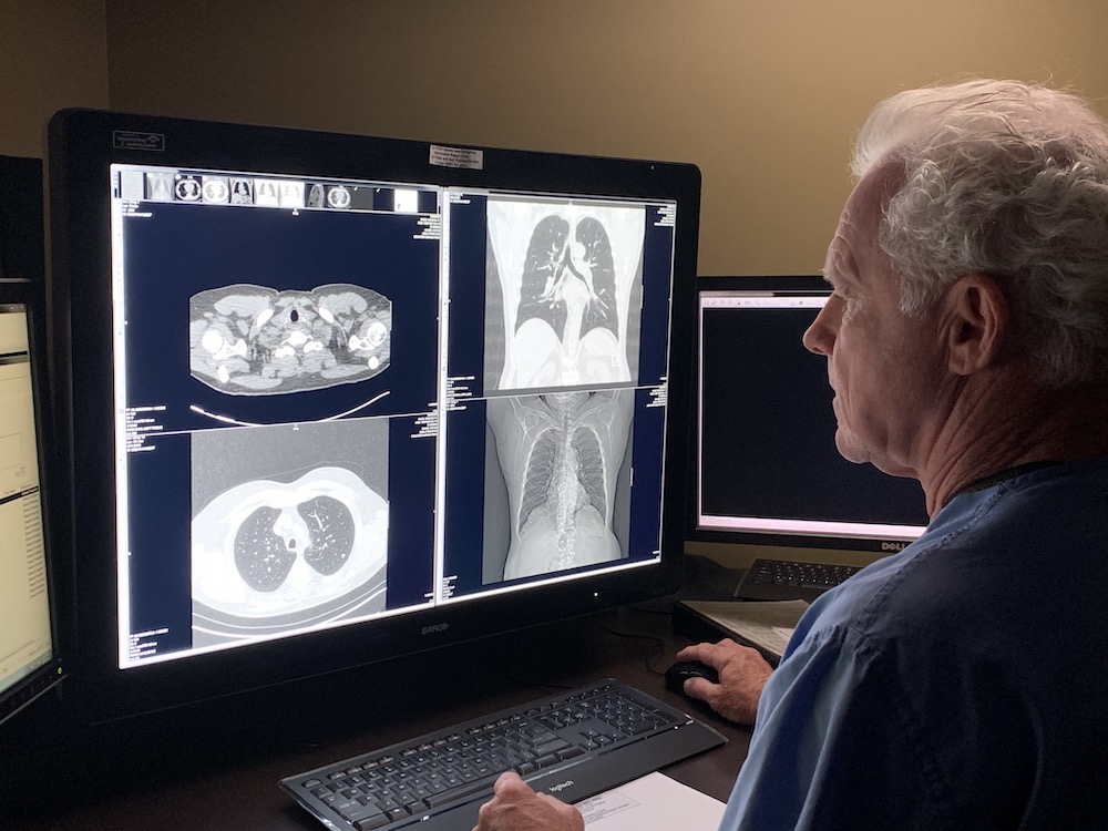 lung screening image