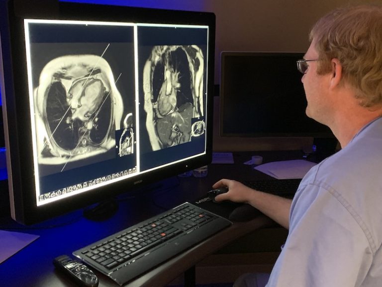 Radiologist reads cardiac MRI