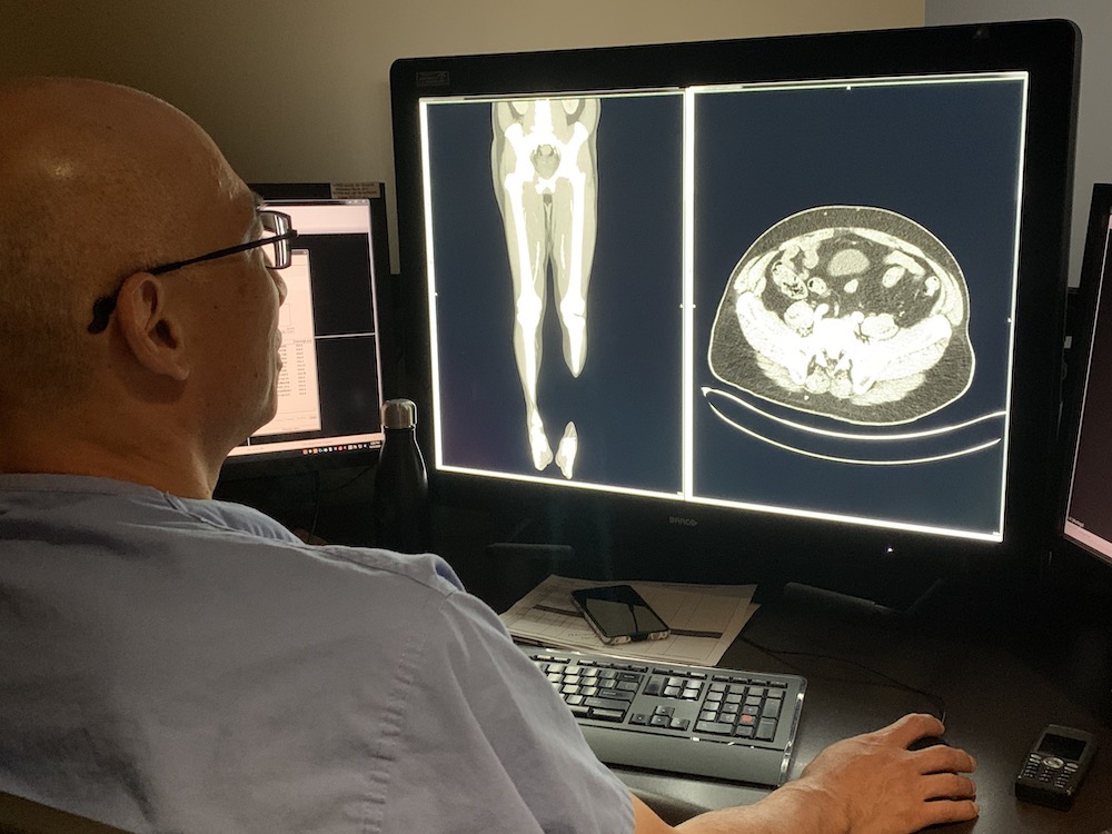 vascular image being read